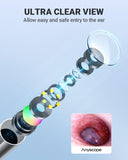 AnyScope Digital Otoscope Compatible with iPhone and Android Devices, HD Ear Camera with Ear Wax Removal Tools, Video Ear Scope Otoscope with Light, Capture Photos and Videos (Silver)