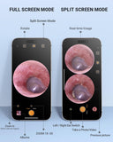 AnyScope Digital Otoscope Compatible with iPhone and Android Devices, HD Ear Camera with Ear Wax Removal Tools, Video Ear Scope Otoscope with Light, Capture Photos and Videos (Purple)