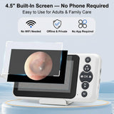 JYTONE Digital Otoscope with 4.5" HD Screen, Ear Wax Removal Tool Kit with Camera, 3.9mm Ear Scope, No App or WiFi Needed, 32GB Card, Visual Ear Cleaner for Adults, Kids & Pets, Photo and Video