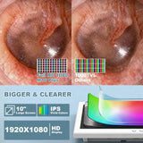 Otoscope Camera - with 10” Screen Otoscope Ear Camera - 1080P HD Ear Camera - 6 LED Lights for Adult and Pet - Support Photo & Video - Type-C Charging with Computer (White)