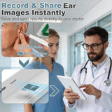 Otoscope Camera - with 10” Screen Otoscope Ear Camera - 1080P HD Ear Camera - 6 LED Lights for Adult and Pet - Support Photo & Video - Type-C Charging with Computer (White)